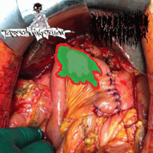 Coprophagic Dysentery : Coprophagic Dysentery - AxOxTxPxWxHxGxLxBx - Terbeschikkingstelling